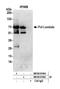 DNA Polymerase Lambda antibody, NB100-81664, Novus Biologicals, Western Blot image 