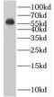 BLK Proto-Oncogene, Src Family Tyrosine Kinase antibody, FNab00906, FineTest, Western Blot image 