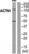 Actinin Alpha 1 antibody, TA311843, Origene, Western Blot image 