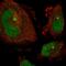 Vacuole Membrane Protein 1 antibody, NBP1-83971, Novus Biologicals, Immunofluorescence image 