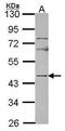 Neuronal pentraxin-2 antibody, PA5-30105, Invitrogen Antibodies, Western Blot image 