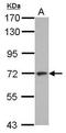 L3MBTL Histone Methyl-Lysine Binding Protein 4 antibody, GTX112290, GeneTex, Western Blot image 