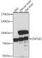 Zinc Finger Protein 182 antibody, 16-608, ProSci, Western Blot image 
