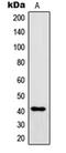 Immunoglobulin Heavy Constant Gamma 1 (G1m Marker) antibody, orb214089, Biorbyt, Western Blot image 