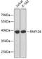 Ring Finger Protein 126 antibody, 18-933, ProSci, Western Blot image 