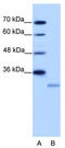 Eukaryotic Translation Initiation Factor 4E Family Member 2 antibody, TA345899, Origene, Western Blot image 