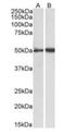Fibrinogen Gamma Chain antibody, orb247026, Biorbyt, Western Blot image 