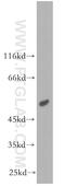 Peroxisomal acyl-coenzyme A oxidase 1 antibody, 10957-1-AP, Proteintech Group, Western Blot image 