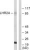 von Willebrand factor A domain-containing protein 5A antibody, abx013269, Abbexa, Western Blot image 