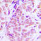 Nuclear Factor I A antibody, LS-C354251, Lifespan Biosciences, Immunohistochemistry paraffin image 