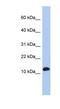 Ribosomal Protein L30 antibody, NBP1-53069, Novus Biologicals, Western Blot image 