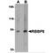 RB Binding Protein 8, Endonuclease antibody, MBS151483, MyBioSource, Western Blot image 
