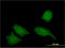 Iron Responsive Element Binding Protein 2 antibody, LS-C197544, Lifespan Biosciences, Immunofluorescence image 