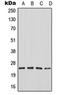 SERTA Domain Containing 1 antibody, orb215154, Biorbyt, Western Blot image 