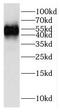 Glucokinase antibody, FNab03385, FineTest, Western Blot image 