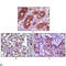 BLK Proto-Oncogene, Src Family Tyrosine Kinase antibody, LS-C812404, Lifespan Biosciences, Immunohistochemistry paraffin image 