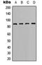 BCL6 Transcription Repressor antibody, LS-C354294, Lifespan Biosciences, Western Blot image 