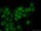 3-Phosphoinositide Dependent Protein Kinase 1 antibody, 17086-1-AP, Proteintech Group, Immunofluorescence image 