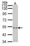 Purinergic Receptor P2X 2 antibody, PA5-28845, Invitrogen Antibodies, Western Blot image 
