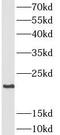 Pulmonary surfactant-associated protein C antibody, FNab07798, FineTest, Western Blot image 