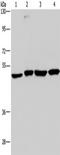 C-C Motif Chemokine Receptor Like 2 antibody, TA351040, Origene, Western Blot image 