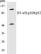 Nuclear Factor Kappa B Subunit 2 antibody, EKC1400, Boster Biological Technology, Western Blot image 