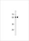 Periphilin 1 antibody, TA328130, Origene, Western Blot image 