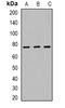 Histone-lysine N-methyltransferase SETMAR antibody, orb382501, Biorbyt, Western Blot image 
