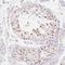 MORC Family CW-Type Zinc Finger 1 antibody, HPA036413, Atlas Antibodies, Immunohistochemistry paraffin image 