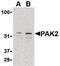 P21 (RAC1) Activated Kinase 2 antibody, PA5-20274, Invitrogen Antibodies, Western Blot image 