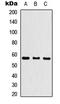 Cytochrome P450 Family 26 Subfamily C Member 1 antibody, abx121469, Abbexa, Western Blot image 