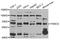 Fanconi anemia group G protein antibody, STJ27962, St John