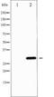 Protein Phosphatase 1 Regulatory Inhibitor Subunit 1B antibody, TA326033, Origene, Western Blot image 