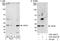 Origin Recognition Complex Subunit 6 antibody, A301-493A, Bethyl Labs, Western Blot image 