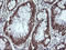 Myosin-binding protein H antibody, LS-C787786, Lifespan Biosciences, Immunohistochemistry frozen image 