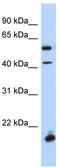 Homeobox protein DBX1 antibody, TA339648, Origene, Western Blot image 