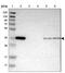 PDZ and LIM domain protein 1 antibody, NBP1-84443, Novus Biologicals, Western Blot image 