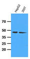 Adenosine Kinase antibody, AM09394PU-N, Origene, Western Blot image 