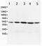 Coi antibody, GTX11619, GeneTex, Western Blot image 