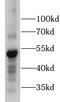 Calcium/Calmodulin Dependent Protein Kinase II Alpha antibody, FNab10481, FineTest, Western Blot image 