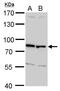 ETS Variant 5 antibody, PA5-30023, Invitrogen Antibodies, Western Blot image 