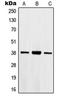 Homeobox B2 antibody, LS-C352309, Lifespan Biosciences, Western Blot image 