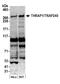 Mediator Complex Subunit 13 antibody, A301-277A, Bethyl Labs, Western Blot image 