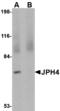 Junctophilin 4 antibody, A13608-1, Boster Biological Technology, Western Blot image 
