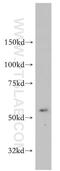 Neutral cholesterol ester hydrolase 1 antibody, 14021-1-AP, Proteintech Group, Western Blot image 