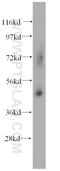Succinate-CoA Ligase GDP-Forming Beta Subunit antibody, 14240-1-AP, Proteintech Group, Western Blot image 