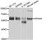 Karyopherin Subunit Alpha 6 antibody, A7363, ABclonal Technology, Western Blot image 