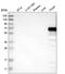 HERV-R_7q21.2 provirus ancestral Env polyprotein antibody, HPA017209, Atlas Antibodies, Western Blot image 