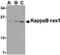 NFKB Inhibitor Interacting Ras Like 1 antibody, PA5-20341, Invitrogen Antibodies, Western Blot image 