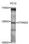 Catenin delta-2 antibody, STJ114507, St John